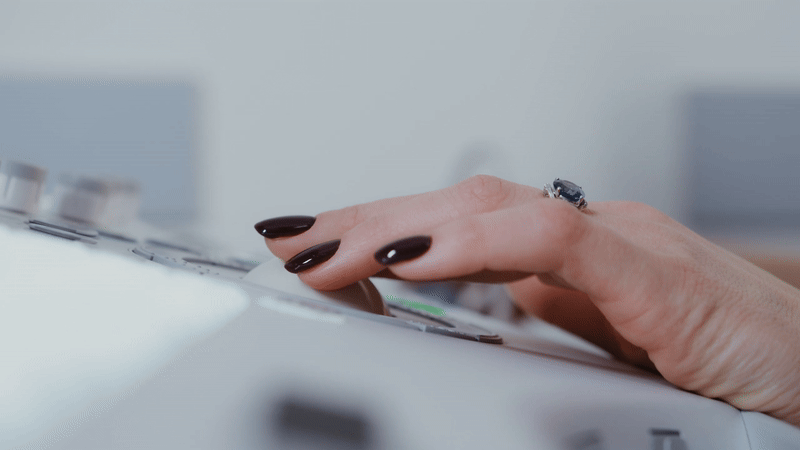 cardiology pacs imaging gif