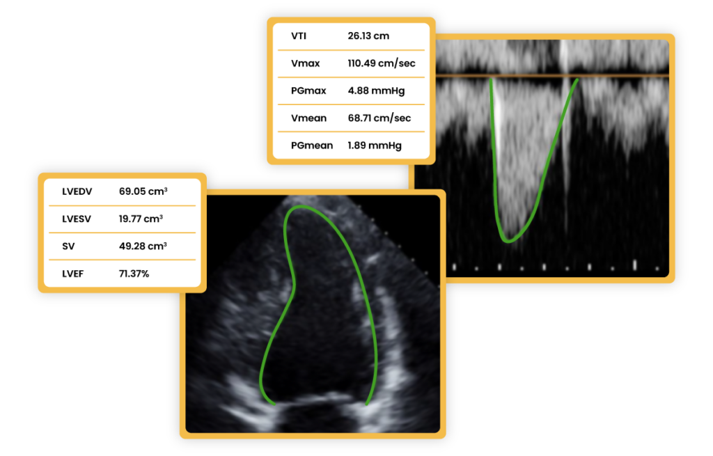 ultralinqs cloud pacs post processing tools sample